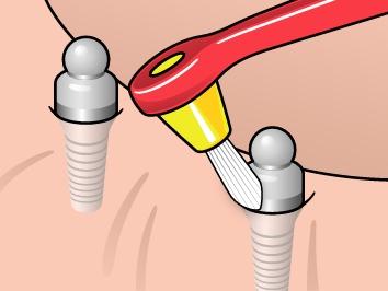 TePe Interspace™ Soft (includes 12 refills)