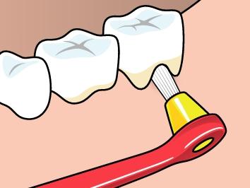 TePe Interspace™ Soft (includes 12 refills)