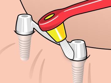 TePe Interspace™ Medium (includes 12 refills)
