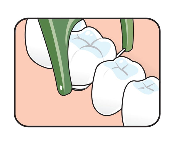 TePe Mini Flosser (36pc/pk) - 2 packs