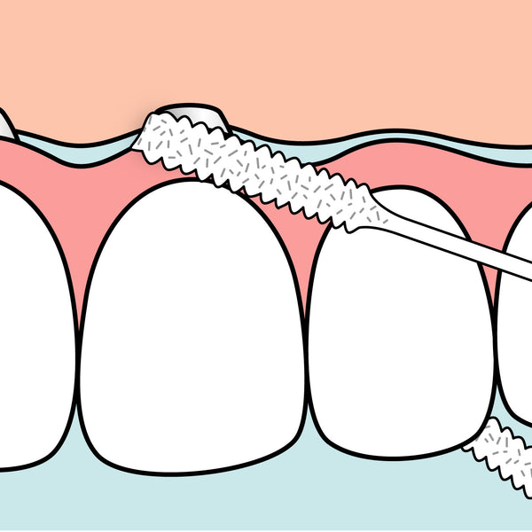 TePe Bridge & Implant Floss™